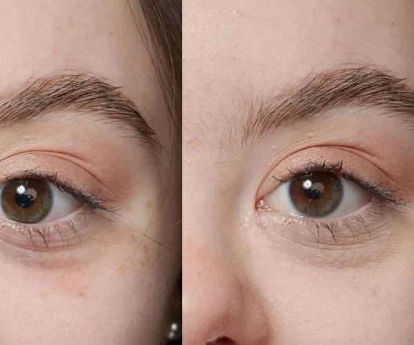 £4 Amazon beauty product with 25,000 five star reviews is ‘great at covering dark circles’