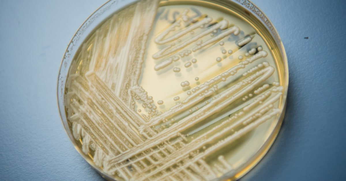 Washington faces first outbreak of Candida auris fungal infections